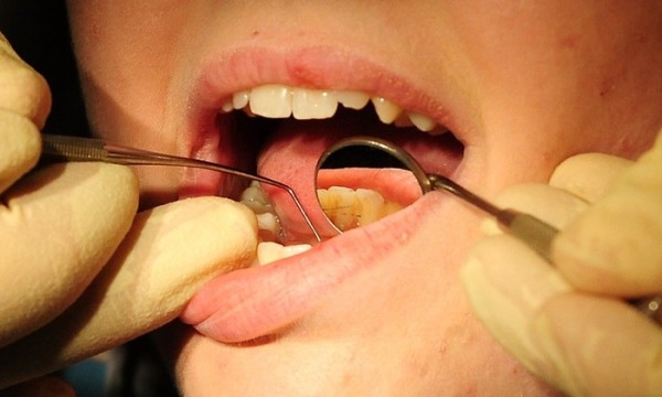 Пассивное курение — путь к детскому стоматологу: новое исследование