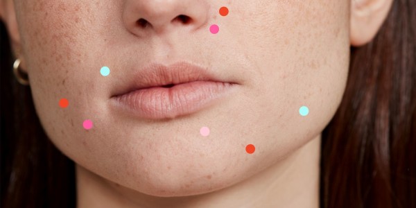 Как гормоны влияют на кожу: какие анализы стоит сдать, если состояние кожи
изменилось